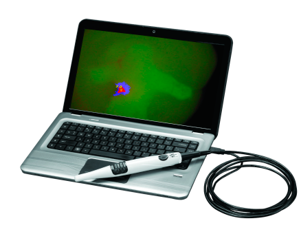 Detector de caries Spectra